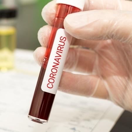 Estudo aponta 3 tipos do novo coronavírus