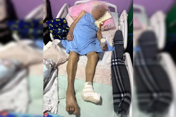Enfermeira que amputou idosa em cirurgia clandestina: “Deu BO com pé”