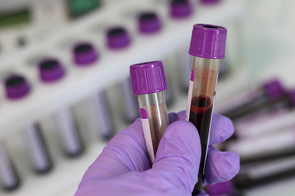 Brasil confirma 4.075 casos e 263 mortes por COVID-19 em 24 horas