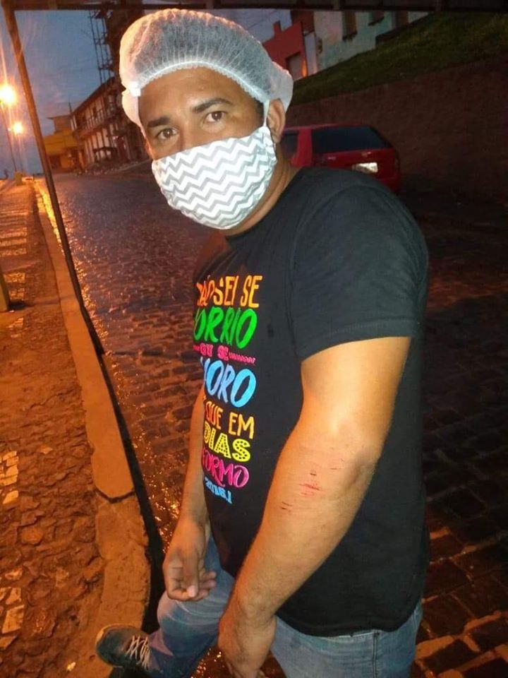 IBIRAPITANGA - Servidor público diz ter sido atropelado em barreira sanitária; fato ocorreu em Itamarati