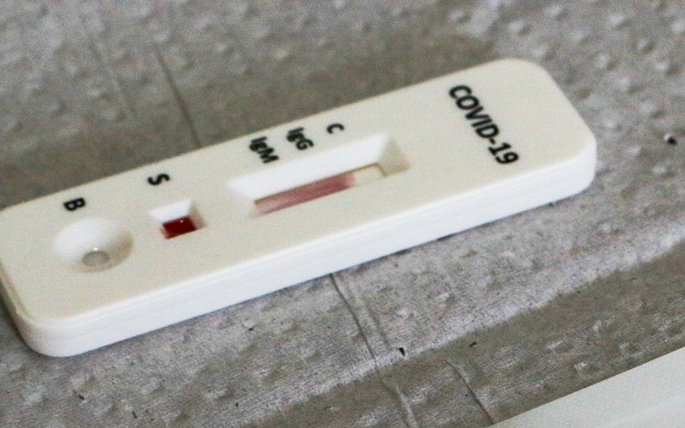Brasil contabiliza média móvel diária de 472 mortes por covid-19