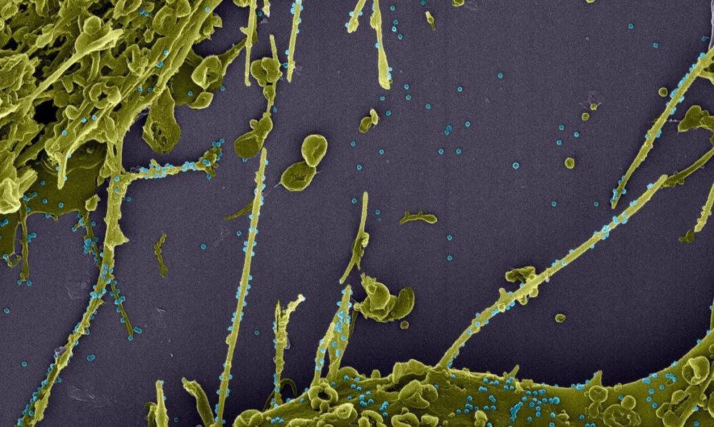 Covid-19: França investiga nova variante que escapa a teste PCR 