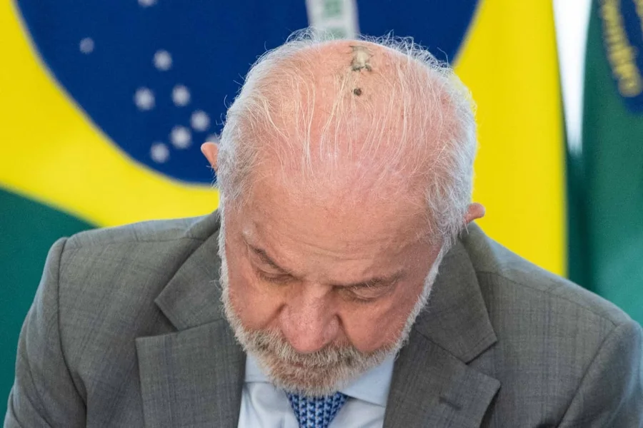 Lula inicia sessões de radioterapia para tratar lesão na cabeça